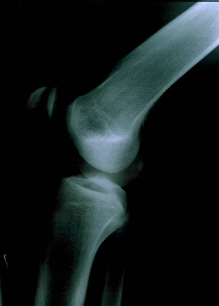 Anatómia Röntgen Betegség Diagnózis — Stock Fotó
