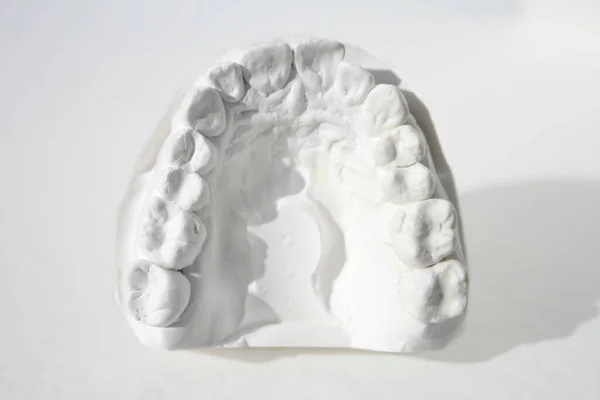 Plaster Model Upper Jaw Female — Stock Photo, Image