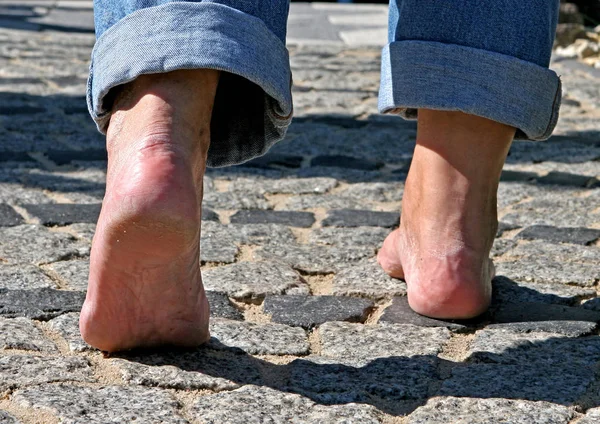 Ноги Человека Инвалидной Коляске — стоковое фото