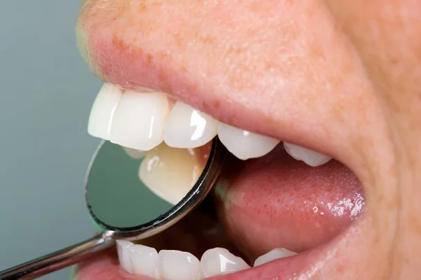 鏡で歯の検査 — ストック写真