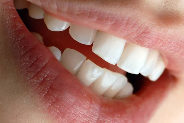 Śmiejące Się Usta Kobiet — Zdjęcie stockowe