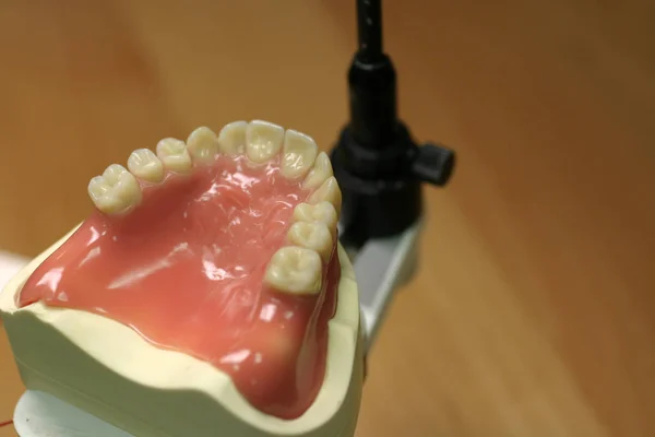 Zębowy Model Górnej Szczęki — Zdjęcie stockowe