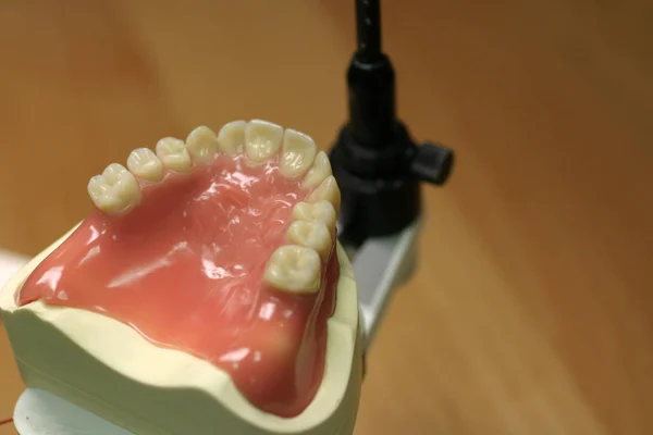 Modelo Dientes Una Mandíbula Superior — Foto de Stock