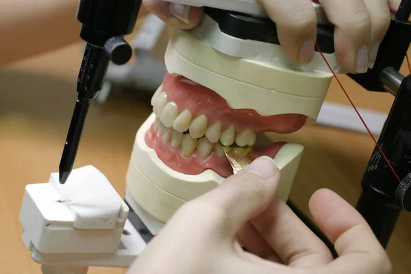 Зубные Модели Верхней Нижней Челюсти — стоковое фото