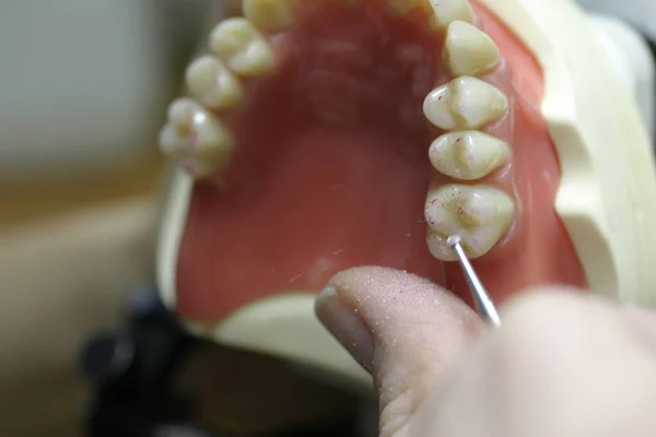 Zębowy Model Górnej Szczęki — Zdjęcie stockowe