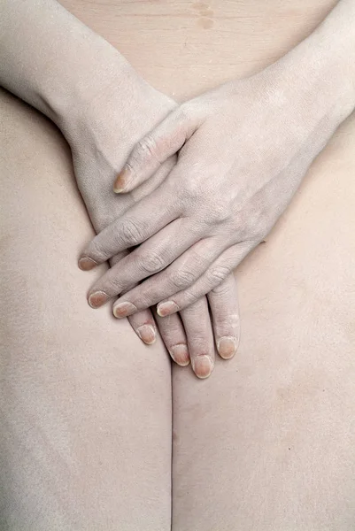 Närbild Kvinnliga Händer Med Smärta — Stockfoto