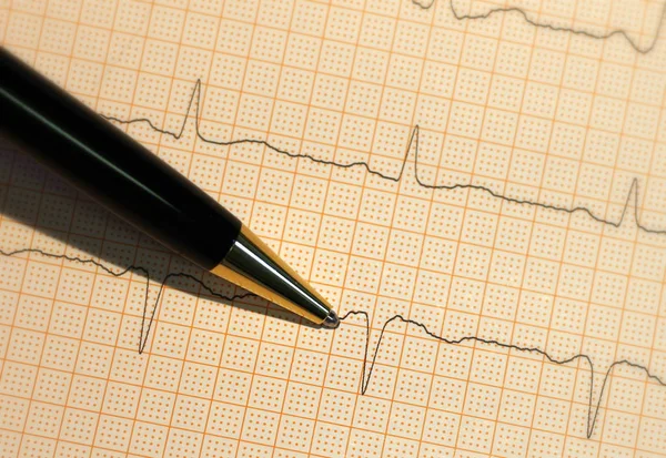 Cardiologia Batimento Cardíaco Ecg Serviço Ambulância — Fotografia de Stock