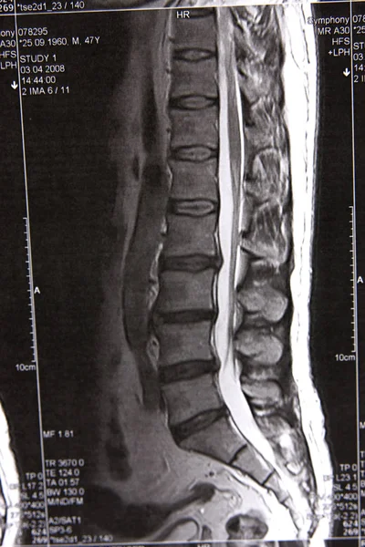 Anatomy Xray Disease Diagnosis — Stock Photo, Image