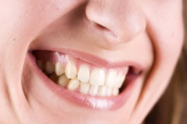 Primo Piano Bocca Femminile Con Denti — Foto Stock