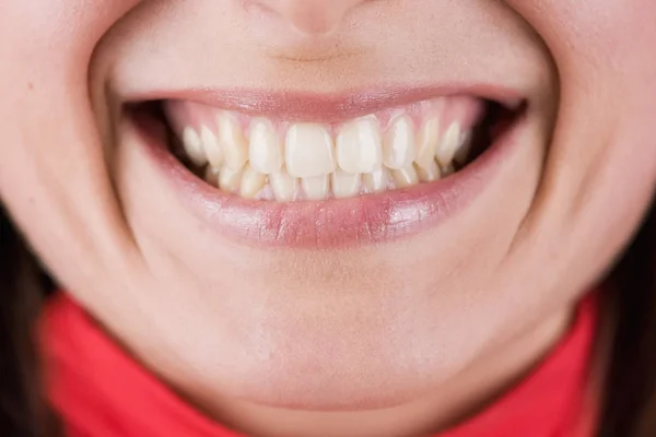 Крупним Планом Жіночі Зуби Посмішкою — стокове фото