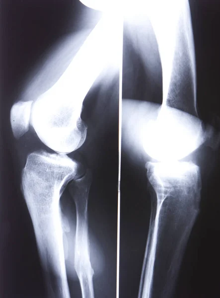 Anatomi Röntgeni Hastalık Teşhisi — Stok fotoğraf
