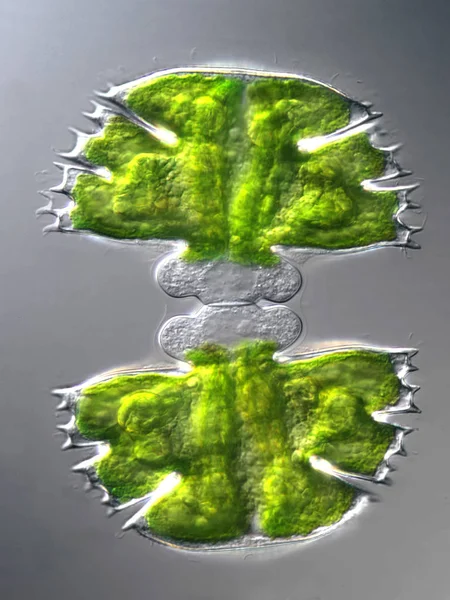 Golden Algae Volvox Colony Uroglena 1000 Stock Photo by ©PantherMediaSeller  334170320