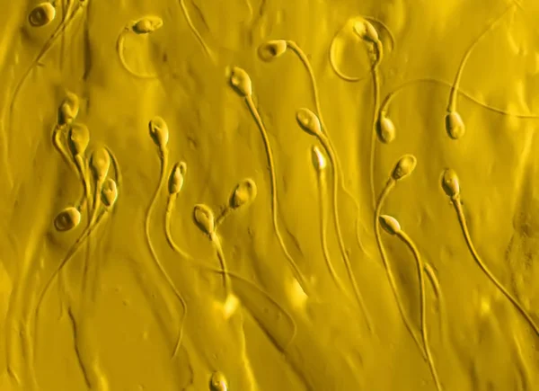Menschliche Spermi Gidiyor 1000 — Stok fotoğraf