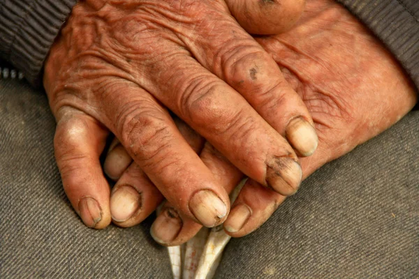 Hands Worker — Stock Photo, Image