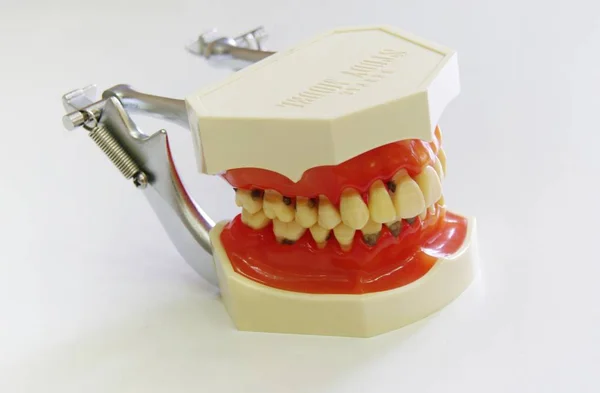 Modelo Dentista Dientes — Foto de Stock