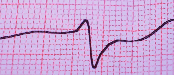 Cardiologia Batimento Cardíaco Ecg Serviço Ambulância — Fotografia de Stock