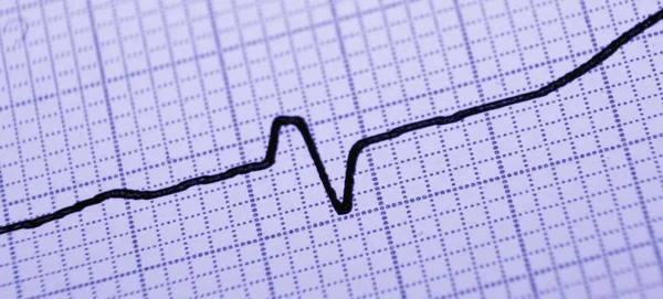 Cardiologia Del Battito Cardiaco Ecg Servizio Ambulanza — Foto Stock