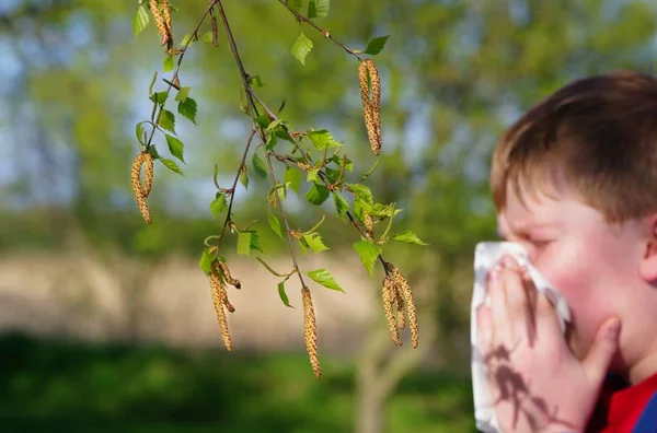 allergy to birch pollen