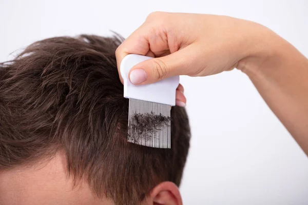 Close Female Doctor Examining Man Hair Comb — Stock Photo, Image