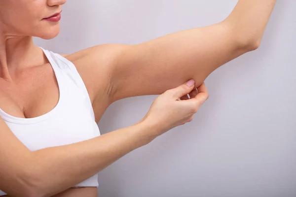 Primer Plano Una Mujer Comprobando Exceso Grasa Sus Brazos Sobre — Foto de Stock