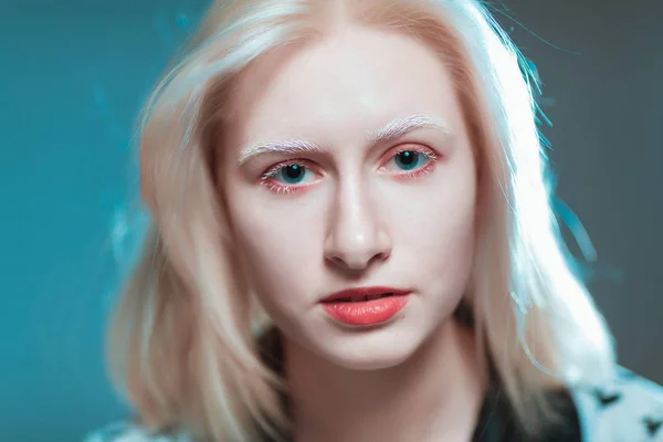 Πορτρέτο Του Albino Ξανθιά Κοπέλα Στο Studio — Φωτογραφία Αρχείου