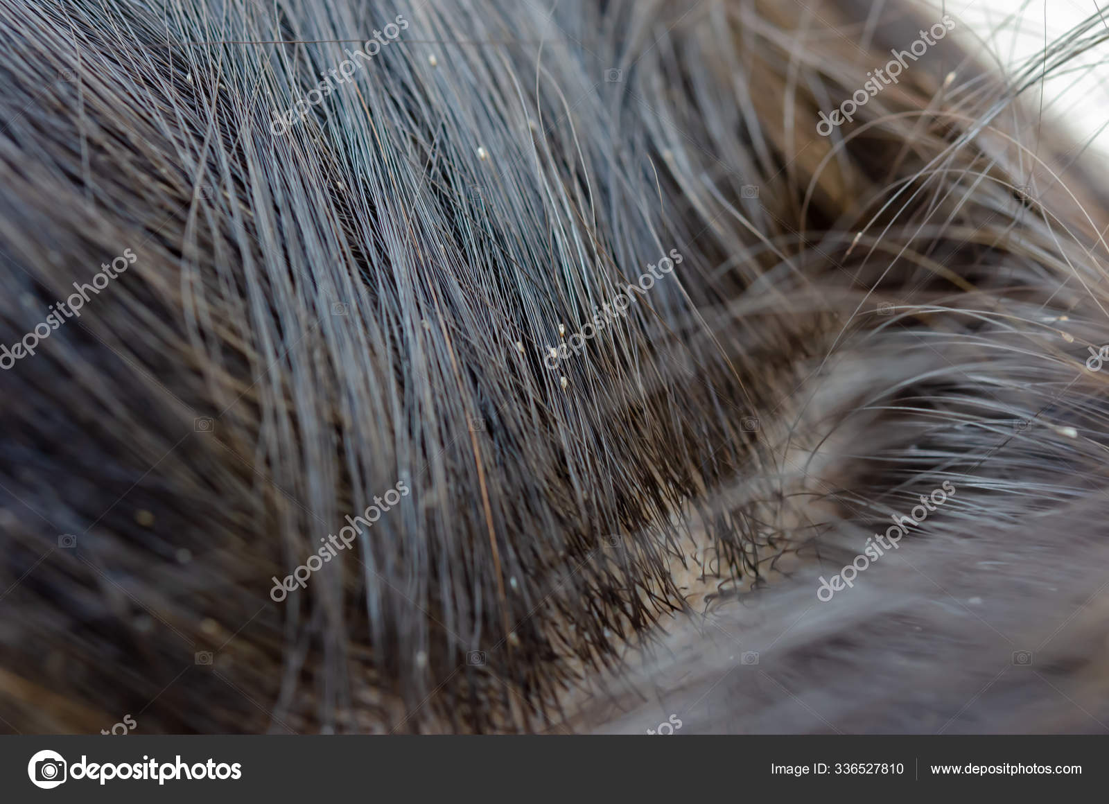 焦虑和对发疯的恐惧- 万博max手机登陆, image size:1600x1160