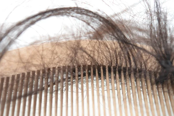 Problema Pérdida Cabello Peine Con Pelo Perdido Aislado Sobre Fondo — Foto de Stock