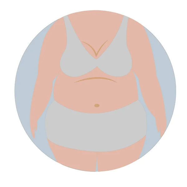 Gruba Kobieta Cellulitis Brzuch Otyłość Nadwaga Wektor Ilustracja — Zdjęcie stockowe