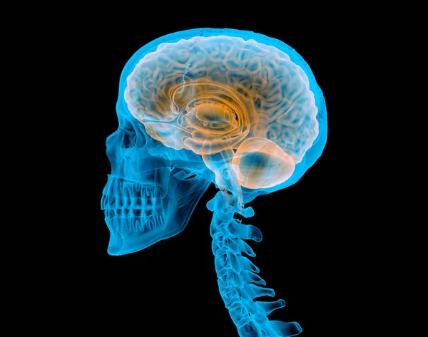 Menschlicher Schädel Mit Gehirn Röntgeneffekt Seitenansicht Auf Schwarzem Hintergrund — Stockfoto