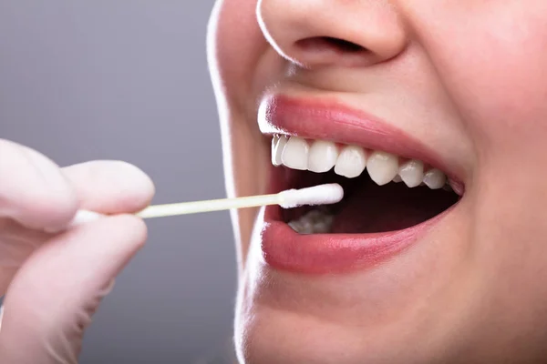 Dentist's Hand Taking Saliva Test From Woman's Mouth With Cotton Swab