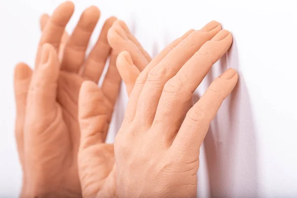 Gruppe Silikonprothesen Hände Medizin Rosa Implantate Für Person — Stockfoto