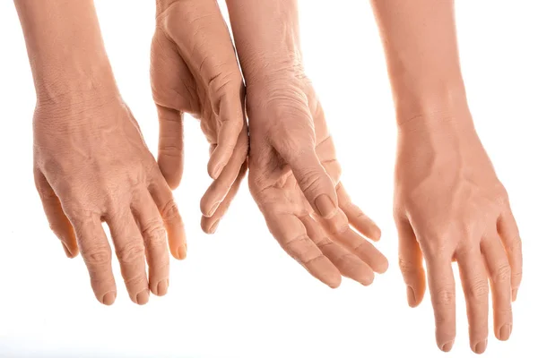Ομάδα Χέρια Πρόθεση Σιλικόνης Φάρμακα Ροζ Εμφυτεύματα Για Άτομο — Φωτογραφία Αρχείου
