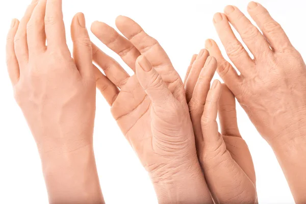 Skupina Silikonové Protézy Ruce Medicína Růžové Implantáty Pro Osobu — Stock fotografie