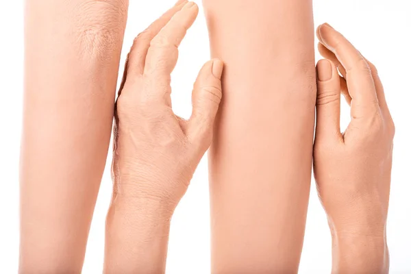 Group Silicone Prosthesis Hands Medicine Pink Implants Person — Stock Photo, Image