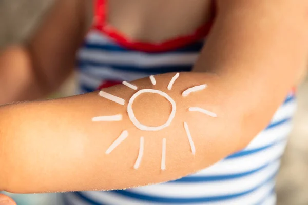 Een Bovenaanzicht Van Zon Getekend Meisje Hand Met Zonnebrandcrème Lotion — Stockfoto