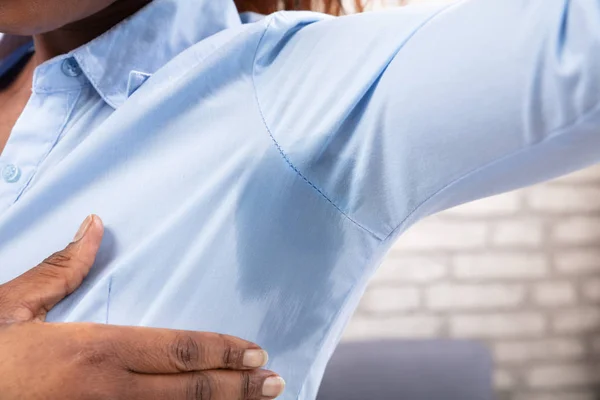 Primer Plano Una Mujer Con Hiperhidrosis Sudando Muy Mal Bajo — Foto de Stock