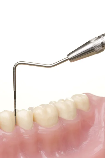 Implante Dental Dientes Aislados Blanco — Foto de Stock