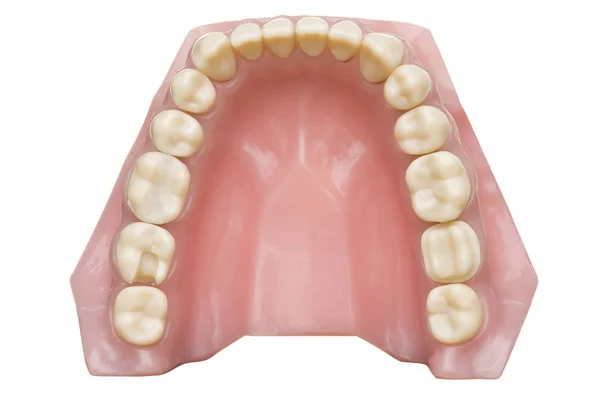 从白色背景分离出来的牙植入物模型 — 图库照片