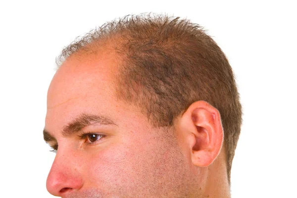 Fiatal Férfi Vékony Haj Mentesül Egy Fehér Felületen — Stock Fotó