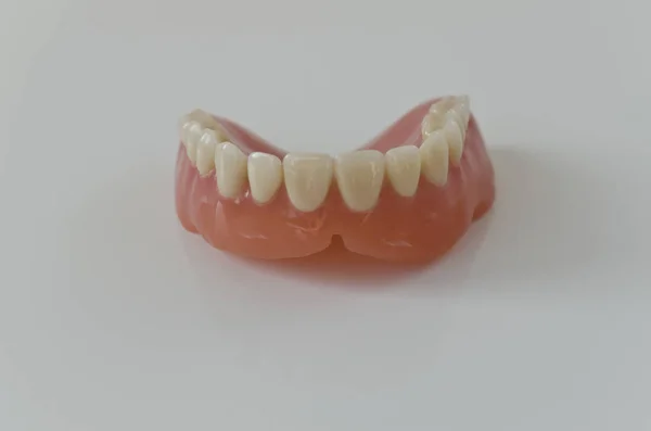 インプラント 歯モデル 入れ歯 歯医者 歯医者 歯ブラシ — ストック写真