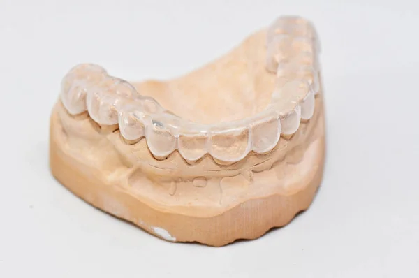 Molde Dentário Dentes Humanos Isolado Branco — Fotografia de Stock