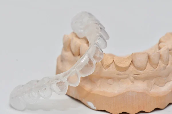 Dental Implant Model Dentists Tooth — Stock Photo, Image