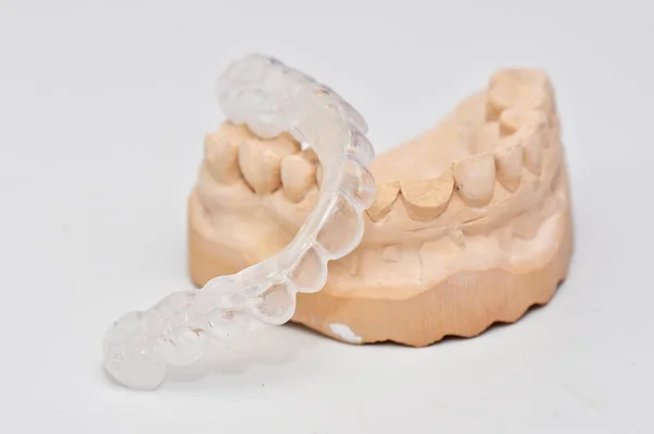 从白色背景分离出来的牙植入物模型 — 图库照片