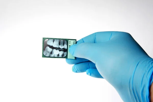 Dentista Revisando Una Radiografía Dientes Humanos Aislado Sobre Blanco —  Fotos de Stock