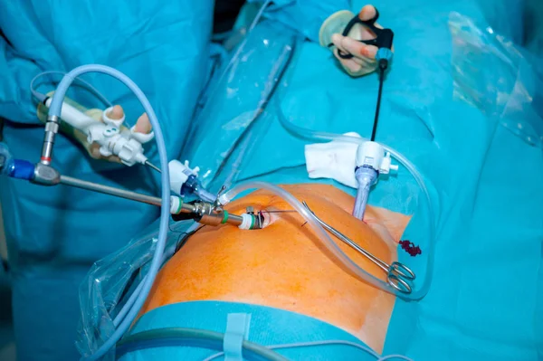 Cirurgiões Que Trabalham Paciente Teatro Operacional Minimamente Invasivo — Fotografia de Stock