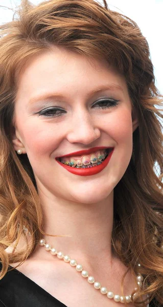 Renkli Diş Telleri Olan Kadın Model — Stok fotoğraf