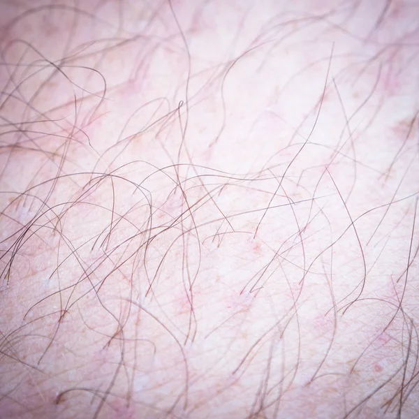 Hair Man Leg Macro Image Fuzz Man Leg — Stock Photo, Image