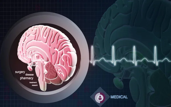 Digitale Darstellung Des Gehirns Farbigen Hintergrund — Stockfoto