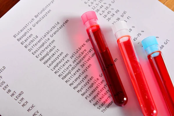 Laboratorní Krevní Testy Laboratorní Medicíny — Stock fotografie