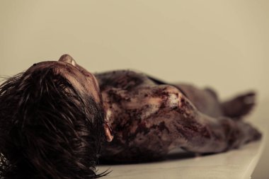 Close up Burnt Body of a Dead Young Boy Lying on the Table in Morgue, Emphasizing Head and Shoulder. clipart